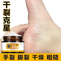 Hands and feet crack Heel Dry crack Peeling Foot crack Dry crack Anti-crack cream Anti-crack hand and foot cream