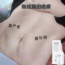 (Weia recommends diluting pregnant womens lines)Dont do  lines”Mom and pregnant body lines say goodbye Buy 2 get 1 free