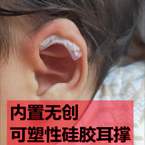 Baby Ear Support Baby Ear Setting Paste Wind Ear Hanging Ear Veneer Ear Correction Ear Artifact Ear Orthotics Paste
