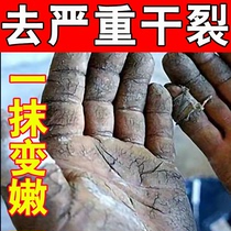 Rhino Cracking Cream Antifreeze Feet Hands And Feet Foot and foot Cracked Tortoise Cracked with finger cracked peeling and moisturizing skin repair deity