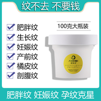 Obesity pattern removal and elimination repair cream repair cream essential oil fat pattern on legs male and female students to remove growth pattern