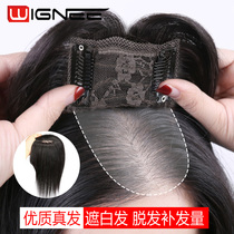 Full real hair head hair patch female cover white hair hair loss thin hair increase invisible and incognito hair rare wigs