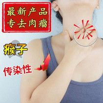 (Poetry jointly produced) The removal of the mole is not a problem. The raised particles naturally fall off without leaving marks.