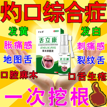 Burning mouth syndrome oral ulceration tongue fever numbness burning spicy pain crack tongue map tongue tongue pain relieving artifact