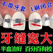 Anti-loosening periodontal abscess Tooth looseness tooth loosening tooth seam wide alveolar bone repair gum bleeding periodontitis special ointment F