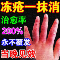 Special ointment for the Prevention of frostbite (a touch of sores) anti-frostbite anti-cracking artifact root swelling and itching hand cream