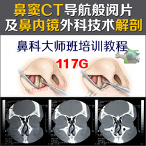 Wu Yanqiao Sinus Sinus CT Navigation-Like and Nasal Endoscopic Surgery Anatomical Training Video Tutorial Notori Master Class