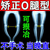 o type leg filling to change straight up to improve calf valgus X type leg Roosphere leg straightaways leg-type melegged divine instrumental post patent