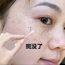 No where the scabs are not a net erase Where to remove all black dot spots on the face down to blackshoot 3 Fat 5