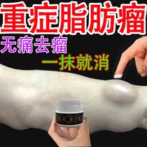 Fatty aneurysm Subcutaneous Fat Tumor Removal Theologer Removes Hard Lump Lump Single Hair Multiple Anti-Tumor Patch