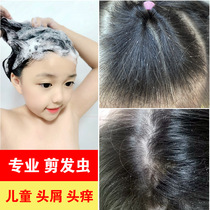 Childrens shampoo Anti-dandruff anti-itching Dandruff in addition to mites and hair cut insects for girls and boys over the age of 6 and 12