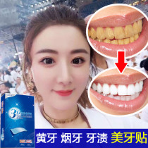 Watsons is selling teeth whitening anti-yellowing artifact Quick-acting white teeth paste Smoke tea stains teeth fluorine spots teeth brightening patches