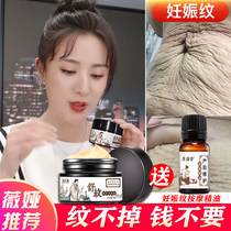 Hundred Chen pattern elimination to stretch marks repair cream care postpartum elimination removal of stretch marks artifact obesity compact
