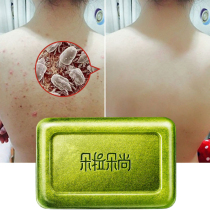 Dorado Shang Mite Soap Face Washing Sulfur Soap Amite Deeplayer Deep Cleansing Men and Mens Faces Degreasing Soap