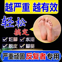  Beriberi root removal artifact anti-itching peeling rotten feet blisters feet odor antibacterial cream itchy feet and special ointment for home remedies
