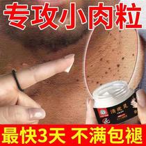 Small meat grains remove clear warts flat and especially filamentous warts common warts calluses busters