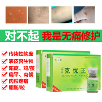 Ke warts sharp wet male and female private parts hp v virus detection podophyllotoxin tincture Pearl rash eczema warts medicine