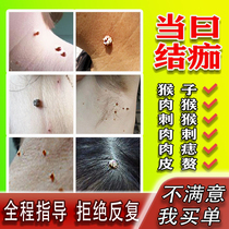 Remove the long neck of the small meat sarcoma pimple meat monkey medicine armpit skin patch