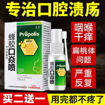 Propolis stomatitis Oral ulcer Childrens choice spray Repeated repair fire Recurrent adult ulcer antibacterial solution