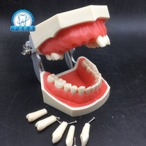 Dental model Dental preparation practice model Removable teeth gingival row soft gums Oral teaching dentist examination