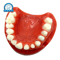 Dental upper frontal dental model half-mouth porcelain preparation demonstration model dentist practice can replace teeth