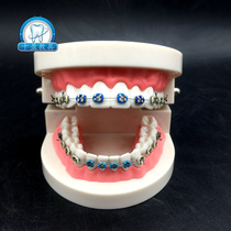 Dental oral standard orthodontic model with bracket teaching model doctor-patient communication practice