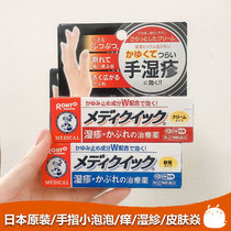 Japanese finger moisturizer hand long small bubble itch hand crack mouth wet hand various problem rash