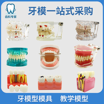 Tooth Model Mold Tooth Model Dental Teaching Model Removable Oral Denture Toothbrushing Teeth Model Resin