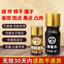 Point Mole paste to mole Mole Spot Nevus No Mark drops Black Dot MOLE Divine Instrumental Mole Wart Verruca Freckle Face Repair Instrument