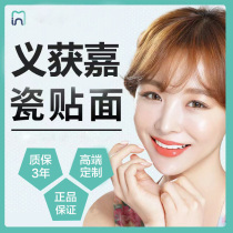 Yiwon Jiaquan porcelain veneered tooth ceramic patch imported tooth paste baked porcelain tooth veneered and whitening tooth crown medenture