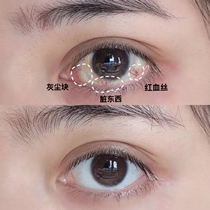  (Recommended by Weia)Tea Polyphenol Eye Care Liquid Eye Cleaning liquid Wash out dirt Buy 2 get 1 free