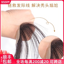 Wig piece female head hair replacement piece high-end invisible and seamless real hair sideburns Forehead hairline bangs patch natural