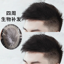 Wig male short hair Handsome real hair Invisible thin mens biological scalp baldness rare wig hair patch top hair
