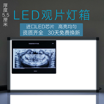 Hospital X-ray LED film viewing light box Ultra-thin dental film viewing reading light single double three and four orthopedic film viewing light