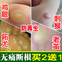 Remove corns water knives dig special ointment repair foot plantar warts calluses in Japan