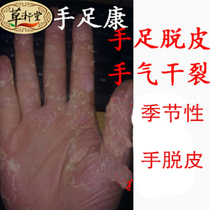 Chapped cream grass xuantang hand foot Kang seasonal hand peeling repair cream hand itching feet hand and foot molting hand