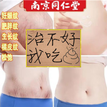  Stretch marks postpartum elimination to dilute care Obesity repair cream Pregnancy to remove belly and tighten pregnancy lines