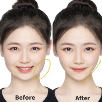 (Weya recommends big face buster small face artifact) Big face does not ask for people to change melon seed face unisex