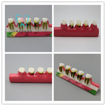 Dental oral teaching periodontal disease classification model doctor-patient communication explanation