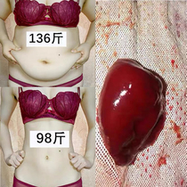 Li Jiaqi recommends rapid tripling to solve many years of troubles fast and thin thick arms and legs to change the bluff