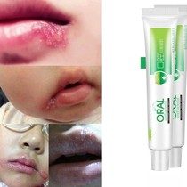 On the mouth fire blisters on the corners of the mouth blisters sticky water on the corners of the mouth red swelling itching rotten fire blistering cream