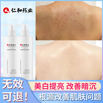 Renhe ingenuity whitening anti-mite shower gel Perfume type long-lasting fragrance for men and women to remove chicken skin pimples