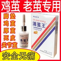 Dropping cocoon Wang Qings feet calluses chicken cocoons removal of foot joints Callus Corpus Callus dead skin softening artifact
