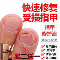 Pangolin Oil Nutrient Solution Pen Nail Care Edge Restoration Nourishing Chia Bed Growth Growth Anti-Barb Medecine Transparent Woman