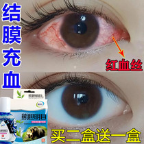 Eyes to red blood eye drops repair removal of eye wash eye drops to yellow eye drops to relieve eye fatigue