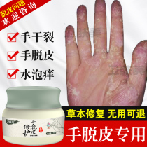 Finger skin peeling severe Palm crack medicine to cure palms chapped hands hand broken skin repair cracked hand skin