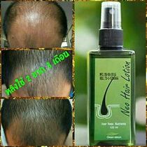 Thailand Neo Hair losion hairline Hair growth fluid anti-clot Hair Baldness alopecia areata nutrient solution