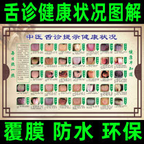 Hospital wall chart tongue diagnosis health status comparison table illustration Chinese medicine physiotherapy oral disease health care poster stickers