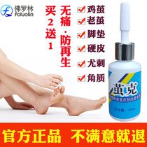 Cocoon Ke angle skin clear removal of cocoon removal of calluses feet and cocoons foot pads dead skin special artifact softener cocoons