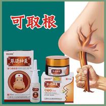 Childrens ventilation Nasal congestion runny nose turbinate hypertrophic grass Yan Shen doctor goose does not eat grass Cangle seed oil 95%are good to use